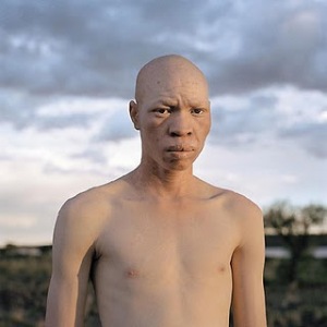 albino tanzania aids killing